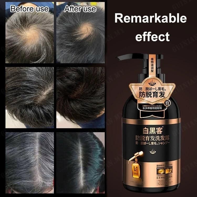herbal anti hair loss shampoo 600ml, anti dandruff hair strengthening shampoo India, shampoo combo for dandruff and hair loss, hair growth and scalp care shampoo India