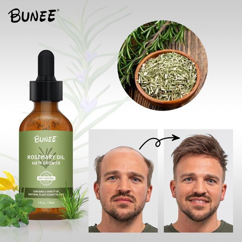BUNEE Rosemary Hair Growth Serum Oil (Pack of 2/3) – Organic Jamaican Black Castor Oil for Hair Regrowth, rosemary hair growth serum, hair growth serum oil, jamaican black castor oil hair serum, hair loss treatment serum, organic hair growth oil, hair regrowth serum for women, natural hair growth serum India, rosemary oil for hair growth, serum for hair thinning, hair serum for all hair types, anti hair fall serum, hair growth treatment oil, liquid hair serum for hair growth, hair growth serum pack of 2,