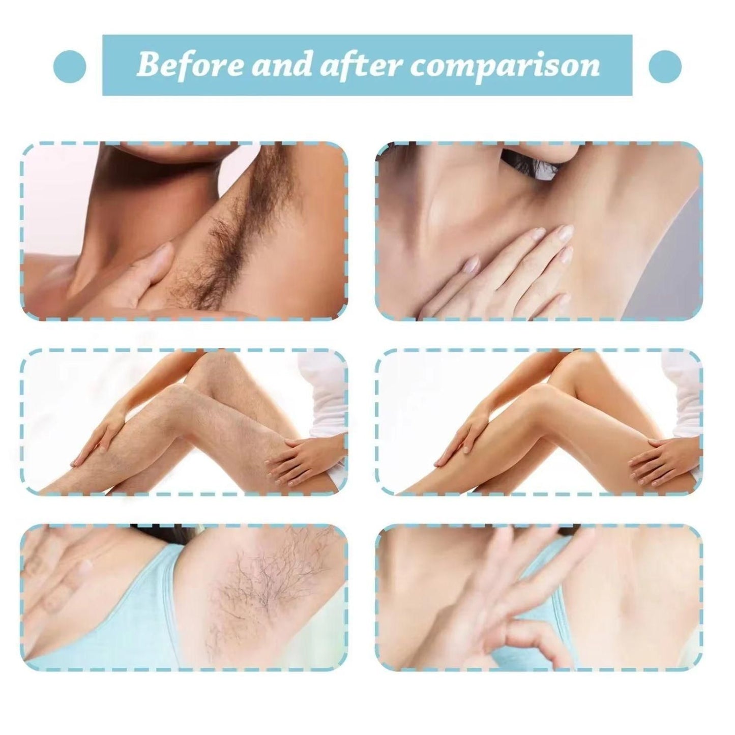 unisex body hair remover spray, chest hair removal spray for men and women, painless hair removal spray, Zidella hair removal spray bottle, effective body hair removal solution, quick-action hair removal spray, Zidella hair remover for chest and body, easy-to-use hair removal spray, Zidella unisex hair removal spray