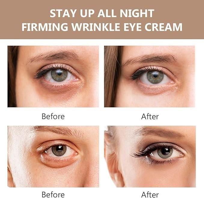 eye bag cream India, moisturizing eye cream, anti wrinkle eye cream, eye tightener cream India, eye cream for fine lines, best eye cream for wrinkles, dark circle remover cream, puffiness reducing eye cream, Instant Firmx eye cream, pack of 2 eye creams India