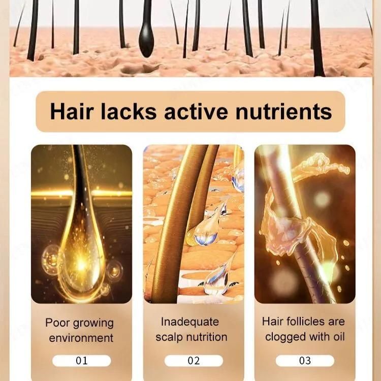 anti hair fall shampoo pack of 2 online, shampoo for hair regrowth and dandruff control, natural shampoo for hair fall and dandruff,