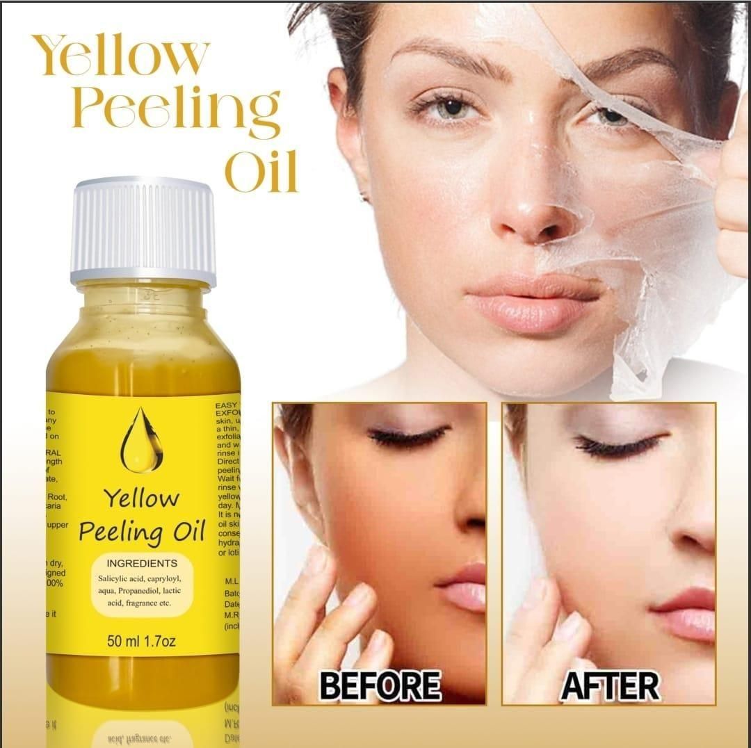 skin brightening peeling oil 50ml pack, peeling oil for face and body pigmentation removal, fast peeling oil for skin whitening, dark skin peeling oil online India