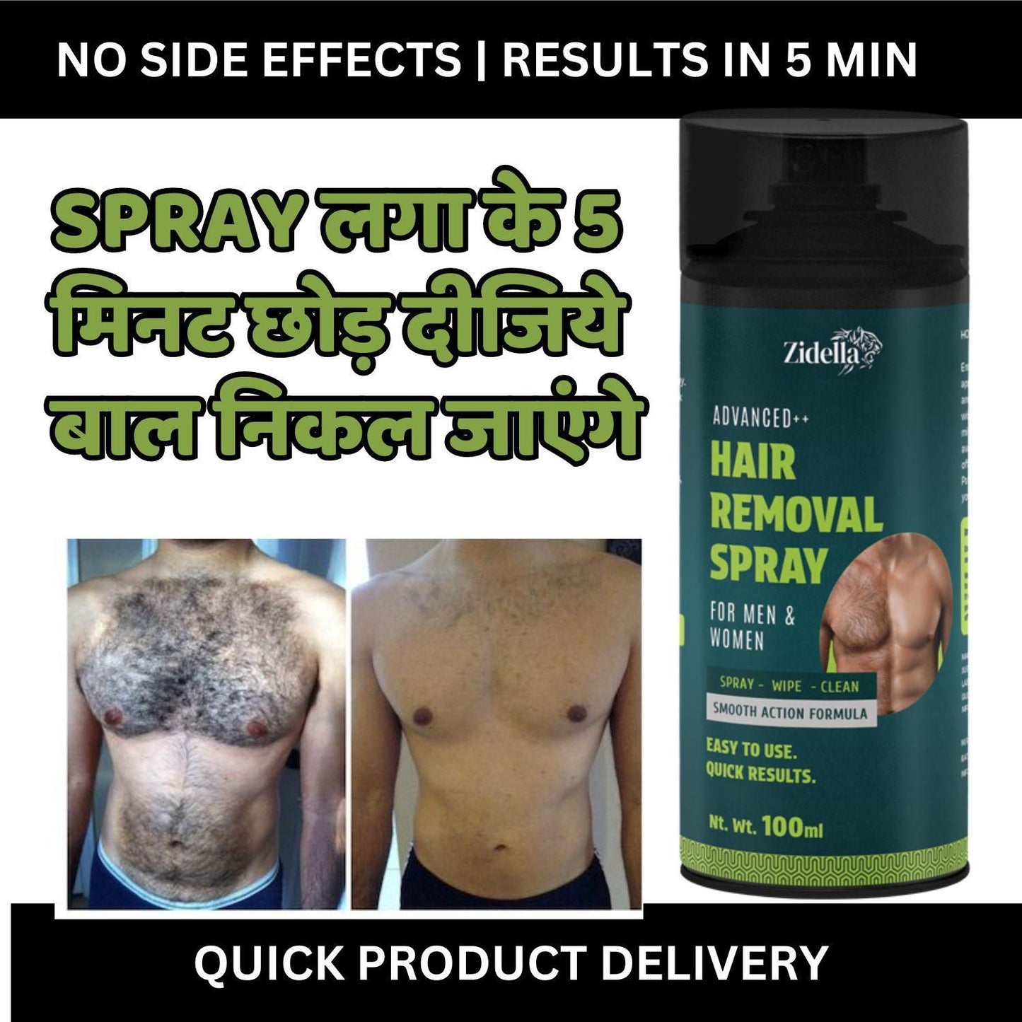 Zidella Safe Hair Removal Spray 100 ml online, unisex body hair remover spray India, chest hair removal spray for men and women, painless hair removal spray for chest and body, Zidella hair removal spray for sensitive skin, effective body hair removal spray for men and women, quick-action hair removal spray for chest and body, Zidella unisex hair removal spray for chest and body, easy-to-use hair removal spray for men and women, Zidella hair remover spray for chest and body