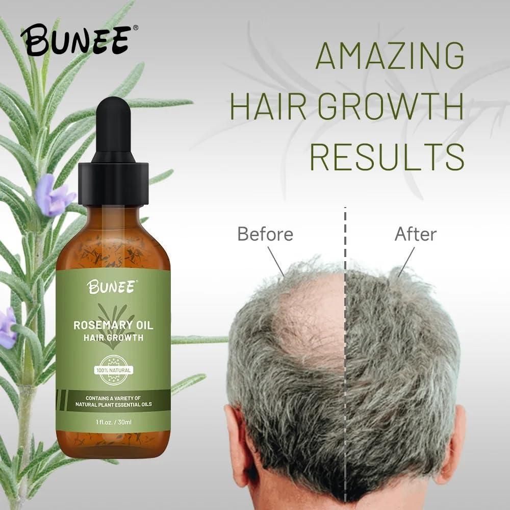hair growth serum India, rosemary oil for hair growth, Jamaican black castor oil India, organic hair oil for regrowth, best hair serum for hair fall, BUNEE hair serum, hair regrowth oil for men and women, natural oil for thick hair, herbal hair serum India, anti-hair fall oil