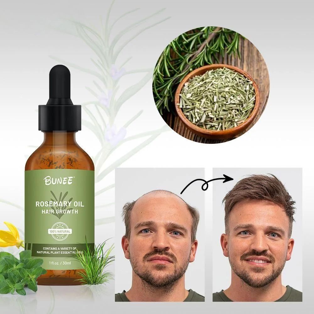 BUNEE Rosemary Hair Growth Serum Oil (Pack of 2/3) – Organic Jamaican Black Castor Oil for Hair Regrowth