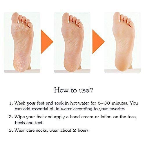 How to use Soft silicone gel foot socks for dry cracked skin