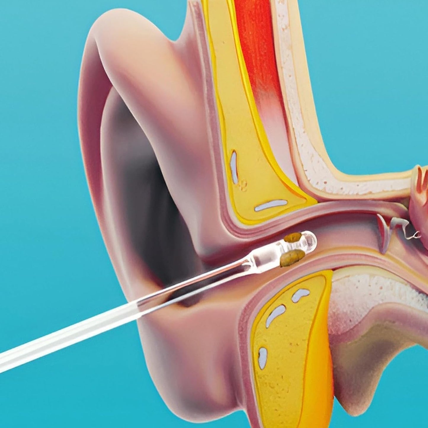 Portable ear wax removal sticks with storage box