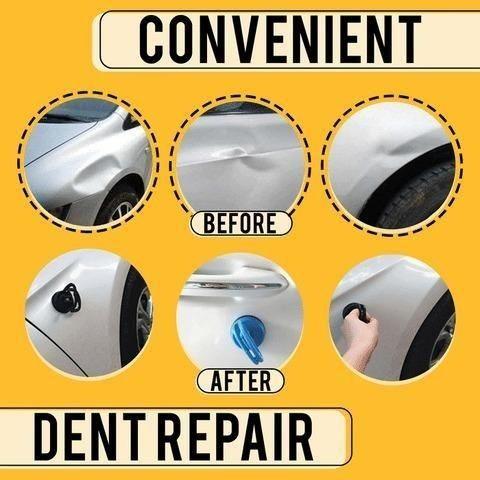 Advance Car Dent Puller – Suction Cup Dent Remover Tool for Easy Car Body Repair, dent puller, car dent puller tool, advance dent remover, suction cup dent puller, dent puller for cars, car body dent remover, plastic dent puller tool, car paintless dent repair tool, suction dent removal tool, car dent repair kit, dent removal suction cup, car body dent suction tool, car dent puller India, easy car dent remover, DIY car dent repair tool

