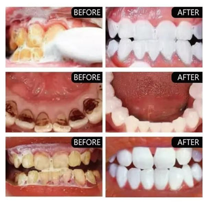toothpaste for coffee stains on teeth, whitening toothpaste for heavy smokers India, 200g stain removal toothpaste twin pack, teeth whitening toothpaste for tobacco users, coffee and smoke stain remover toothpaste, brightening toothpaste for discolored teeth, anti-stain toothpaste for daily use, strong whitening toothpaste for stubborn stains